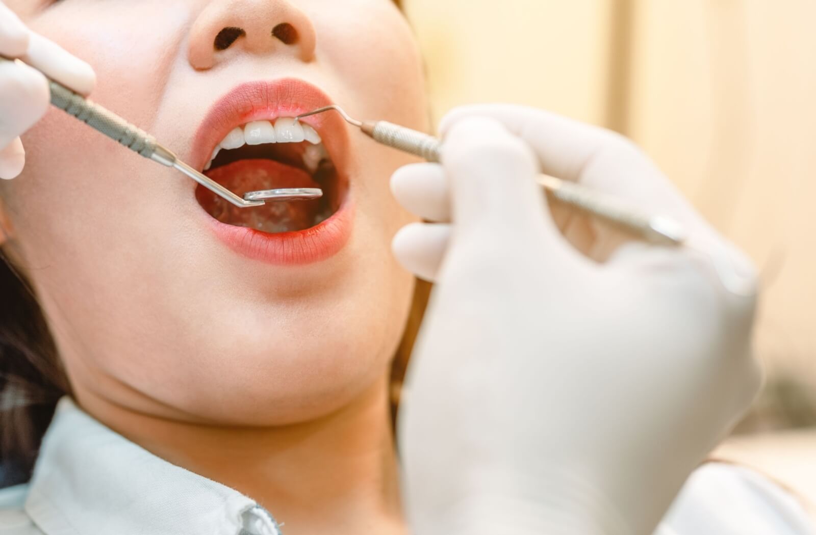 Dentist performing a dental cleaning on a patient to address gingivitis and improve oral health