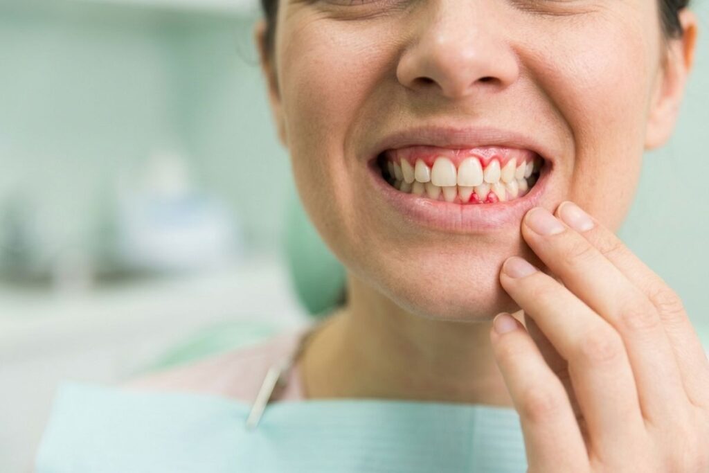 Smiling adult in a dental bib baring their teeth, showing red blood along the gumline. Their fingers rest on their chin.